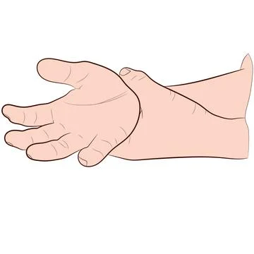 Image graphics vector outline Wrist pain is often caused by sprains Stock-Illustration
