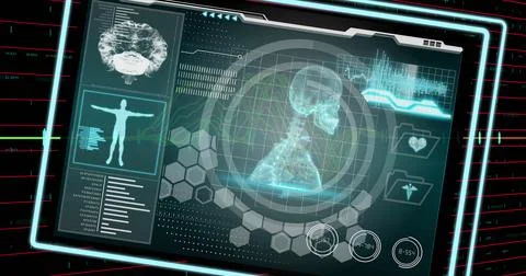 Image of medical data processing over financial data processing on black Stock Photos