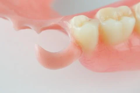 Image of a modern denture on a white background Stock Photos