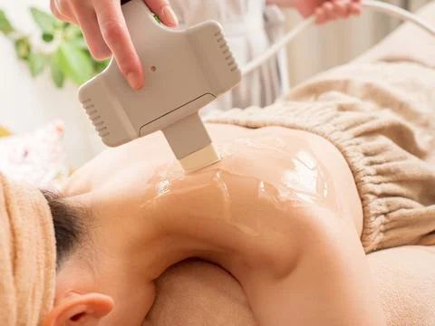 Image of photo epilation on the back Stock Photos