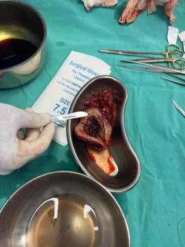Image of Surgically Removed Appendix After Inflammation L2 Stock Photos