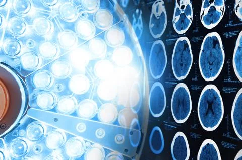 Images from a computerized tomography of the brain and surgical lamps 스톡 사진
