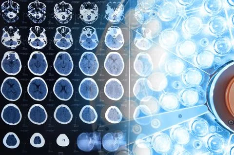 Images from a computerized tomography of the brain and surgical lamps Stock Photos