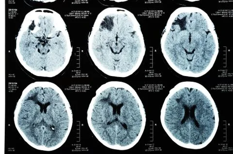 Images from a computerized tomography Foto stock