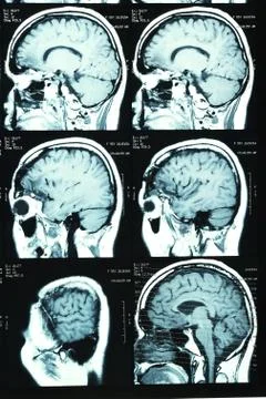 Images from a computerized tomography Stock Photos
