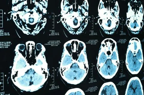 Images from a computerized tomography Stock Photos