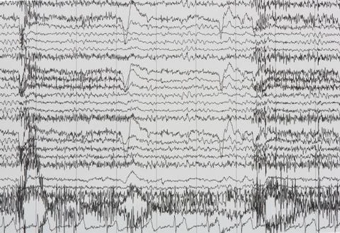 Imaging of electroencephalography recording of human Stock Photos