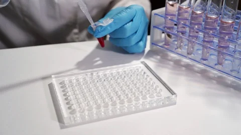 Immunological blood test. A laboratory assistant in a modern place makes a blood Video stock 119145192