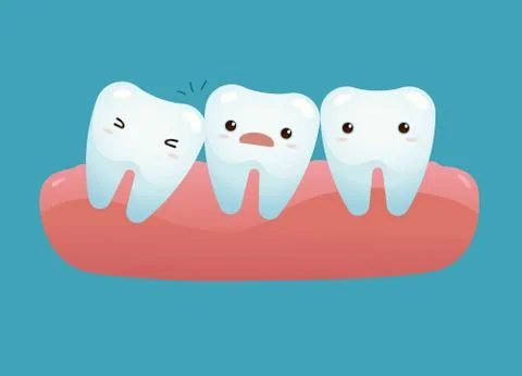 Impacted tooth Stock Illustration