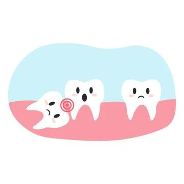 Impacted wisdom tooth in cartoon flat style. Vector illustration of disgruntled Stock Illustration