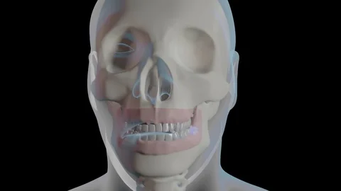 Impacted Wisdom Tooth Stock Footage 122123459