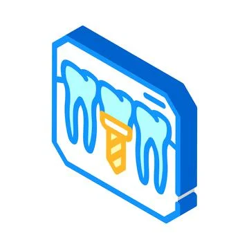 Implant check isometric icon vector illustration sign Illustrazione stock