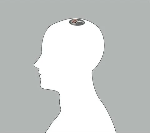 Implant chip back Stock Illustration