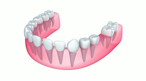Implant is embedded in the gum Stock Footage 19047377
