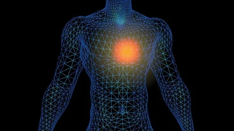 Implant inside chest Stock Footage 84666599