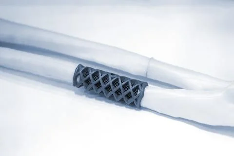 Implants and prostheses printed on 3D printer from biocompatible titanium powder Stock Photos