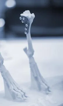 Implants and prostheses printed on 3D printer from biocompatible titanium powder Stock Photos