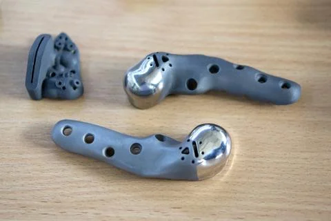 Implants and prostheses printed on 3D printer from biocompatible titanium powder Stock Photos