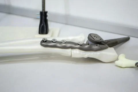 Implants and prostheses printed 3D printer from biocompatible titanium powder. Stock Photos