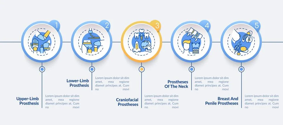 Implants types vector infographic template Stock Illustration