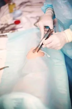 Imposition of single stitches on the wound Stock Photos