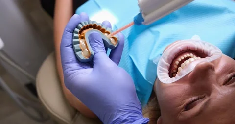 Impression of dental impression material and dental technician creates dental Stock Footage 211724528