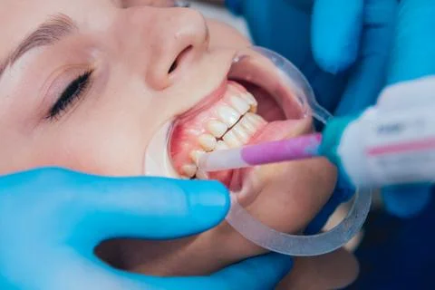 Impression taking and bite registration. Functional diagnostics Stock Photos