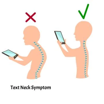 Improper posture symptoms. Text Neck Syndrome. Spinal curvature, kyphosis Stock Illustration
