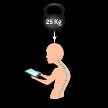 Improper posture symptoms. Text Neck Syndrome. Spinal curvature, kyphosis Stock Illustration