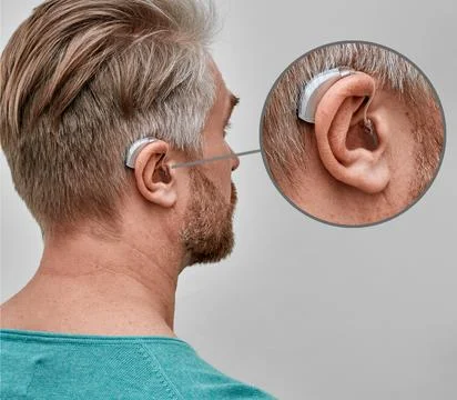 Improving hearing with hearing aids. Hearing aid behind the ear of adult ma.. Fotos Stock