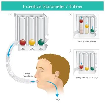 Incentive Spirometer.  Triflow Lung Exercise Device Illustration.. Stock Illustration