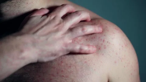 Incorrect body hygiene, excessive sweating, food, chemicals or medicine Stock-Footage 301377232