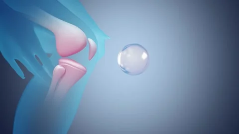 Increase collagen around the knee joint and take care of and prevent the det Stock Footage 308067297