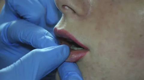 Increase the Volume of Lips Stock Footage 65990786