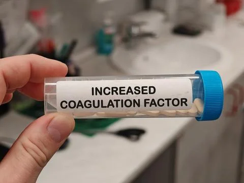 INCREASED COAGULATION FACTOR VIII CONCENTRATION for bleeding disorders clotting Stock Photos