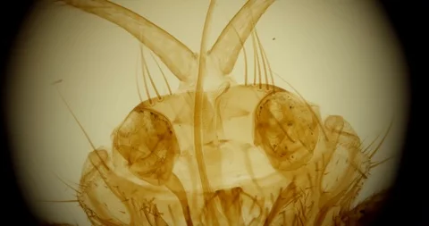 Incredible macro of a sheep tick (Monster) Ultra Macro through microscope Stock Footage 110645871