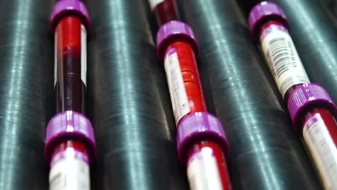 Incubation of blood samples Vídeo Stock 289617280