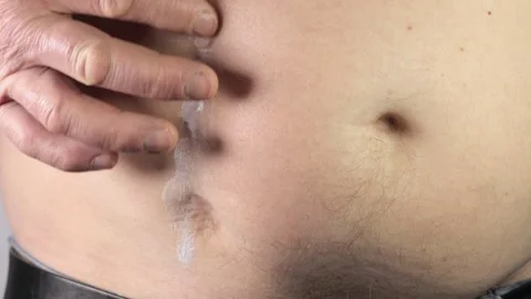 Indented scar 스톡 동영상 308390240