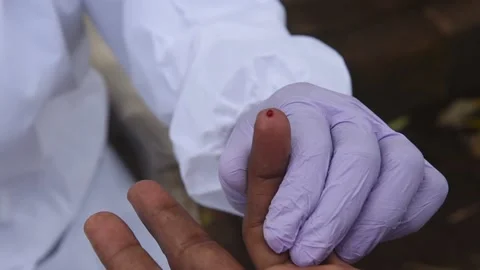 INDIA-BLOOD TEST-MALARIA Stock Footage 146629607