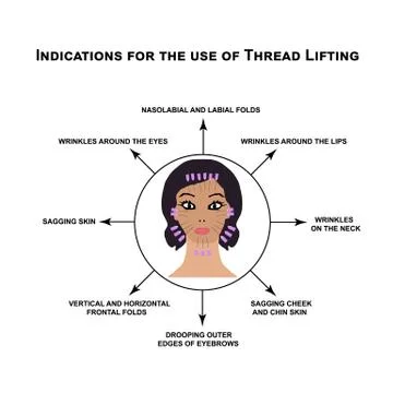 Indications for the use of thread lifting. Mesotherapy Wrinkles. Infographics Stock Illustration