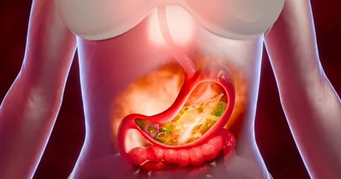 Indigestion and digestive system issues conceptualized with detailed stomach pai Stock Footage 281767605