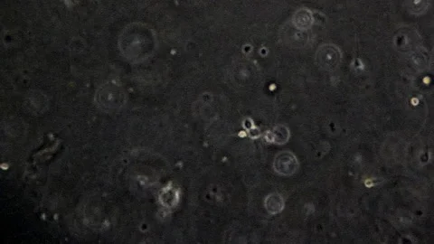 Individual sperm cells seen through a phase contrast microscope. Stock Footage 252786077