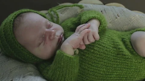 An infant with allergy on his cheeks sleeping Stock Footage 67520380