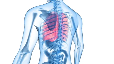 Infected human lungs Stock Footage 165154237