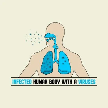 Infected human respiratory tract vector Illustration Stock Illustration