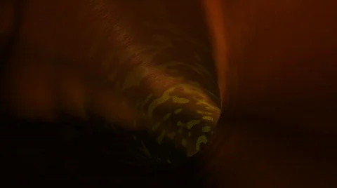 Infected vein 스톡 동영상 83875