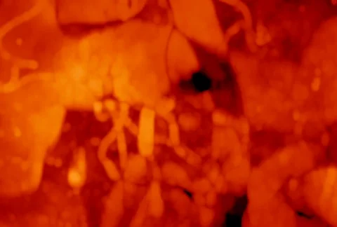 Inferno/MDI 26 스톡 동영상 64568