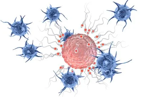 Infertility concept, microbes attacking egg cell surrounded by spermatozoons  Stock Illustration