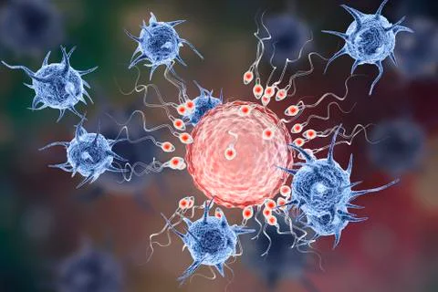 Infertility concept, microbes attacking egg cell surrounded by spermatozoons  Stock Illustration