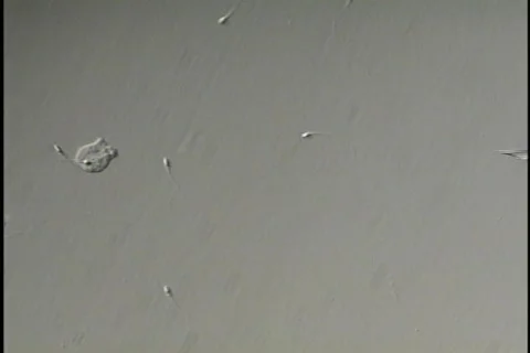 Infertility Treatment 06 microscope Video stock 455252